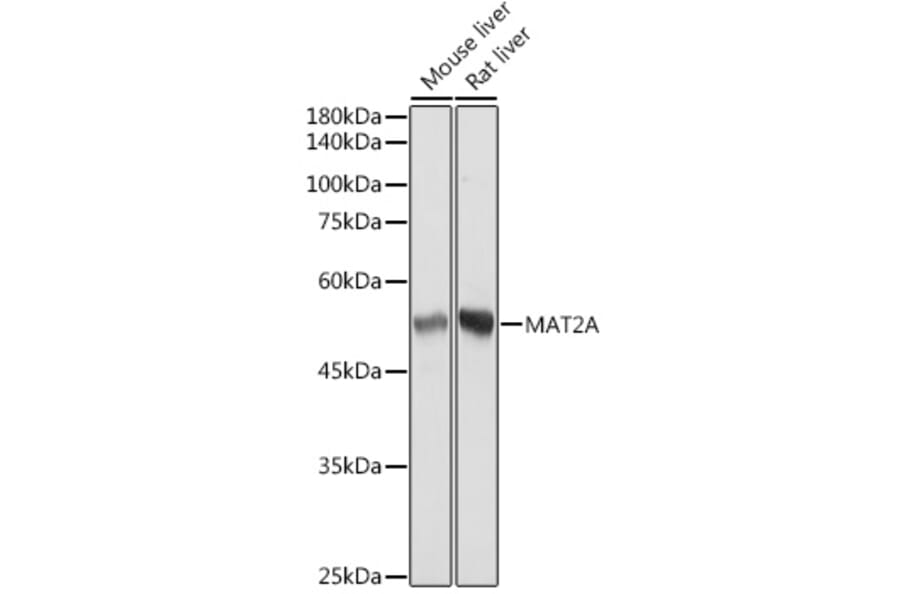 Western Blot - Anti-MAT2A Antibody [ARC2447] (A307555) - Antibodies.com