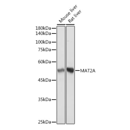 Western Blot - Anti-MAT2A Antibody [ARC2447] (A307555) - Antibodies.com