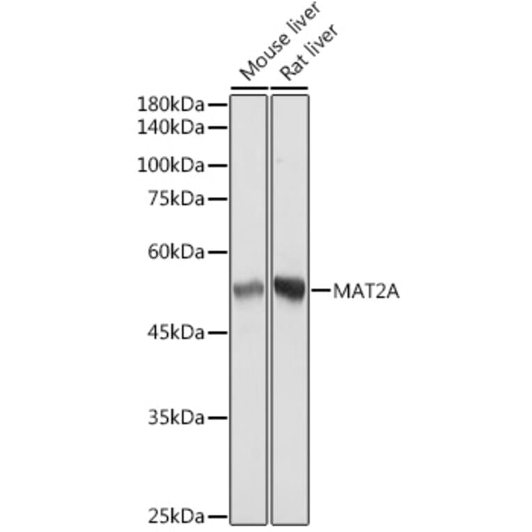 Western Blot - Anti-MAT2A Antibody [ARC2447] (A307555) - Antibodies.com