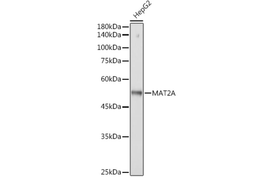 Western Blot - Anti-MAT2A Antibody [ARC2447] (A307555) - Antibodies.com