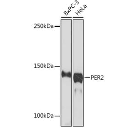 Western Blot - Anti-PER2 Antibody [ARC1134] (A307556) - Antibodies.com