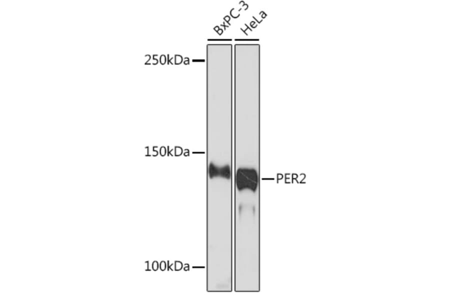 Western Blot - Anti-PER2 Antibody [ARC1134] (A307556) - Antibodies.com