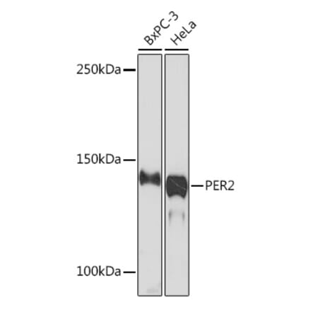 Western Blot - Anti-PER2 Antibody [ARC1134] (A307556) - Antibodies.com