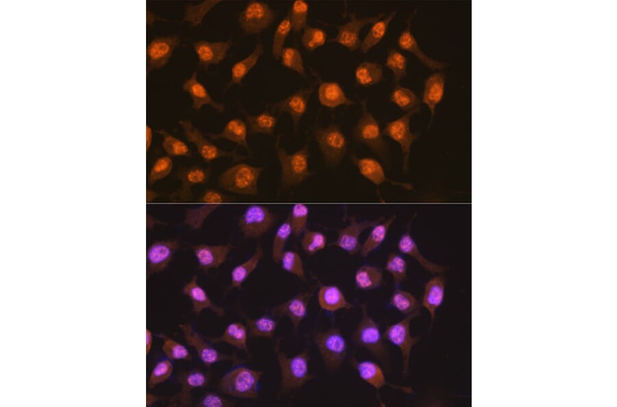 Immunofluorescence - Anti-PER2 Antibody [ARC1134] (A307556) - Antibodies.com