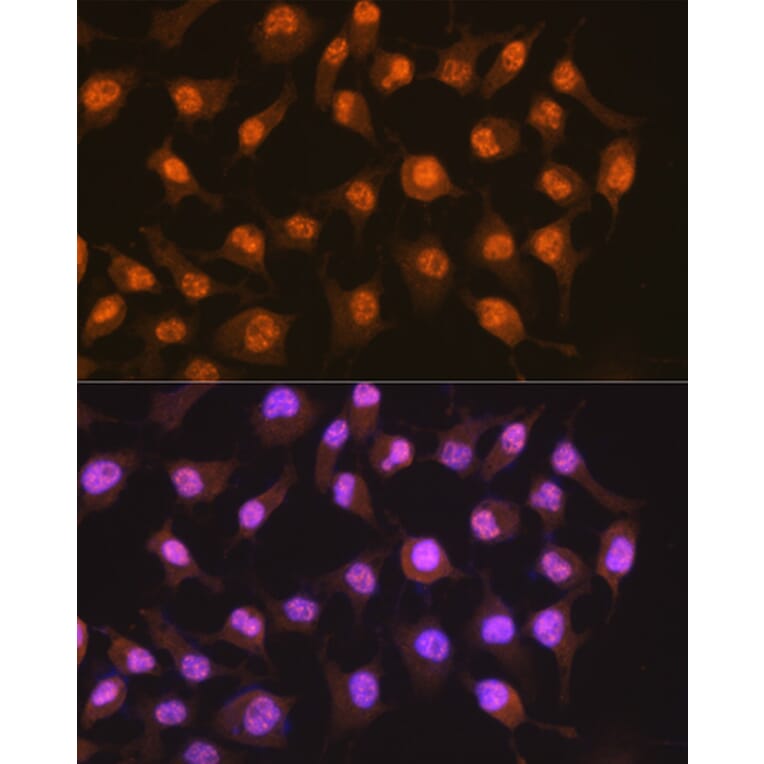Immunofluorescence - Anti-PER2 Antibody [ARC1134] (A307556) - Antibodies.com