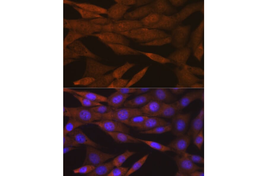 Immunofluorescence - Anti-PER2 Antibody [ARC1134] (A307556) - Antibodies.com