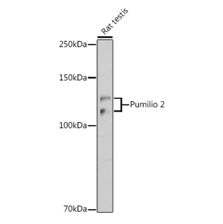 Western Blot - Anti-Pumilio 2 Antibody [ARC2308] (A307557) - Antibodies.com