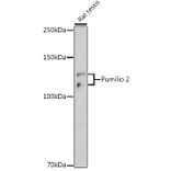 Western Blot - Anti-Pumilio 2 Antibody [ARC2308] (A307557) - Antibodies.com