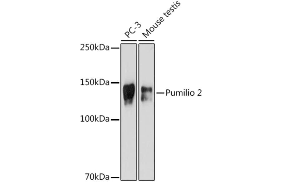 Western Blot - Anti-Pumilio 2 Antibody [ARC2308] (A307557) - Antibodies.com