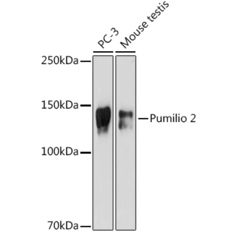 Western Blot - Anti-Pumilio 2 Antibody [ARC2308] (A307557) - Antibodies.com