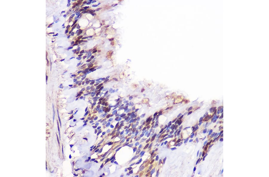Immunohistochemistry - Anti-JMJD6 Antibody (A307558) - Antibodies.com