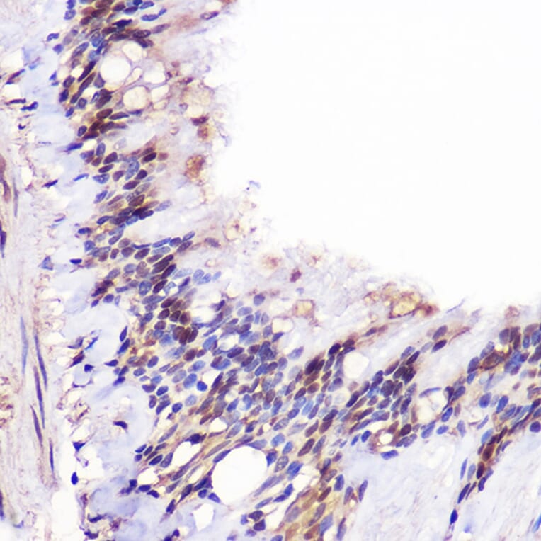 Immunohistochemistry - Anti-JMJD6 Antibody (A307558) - Antibodies.com