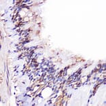 Immunohistochemistry - Anti-JMJD6 Antibody (A307558) - Antibodies.com