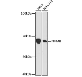 Western Blot - Anti-NUMB Antibody [ARC1390] (A307559) - Antibodies.com