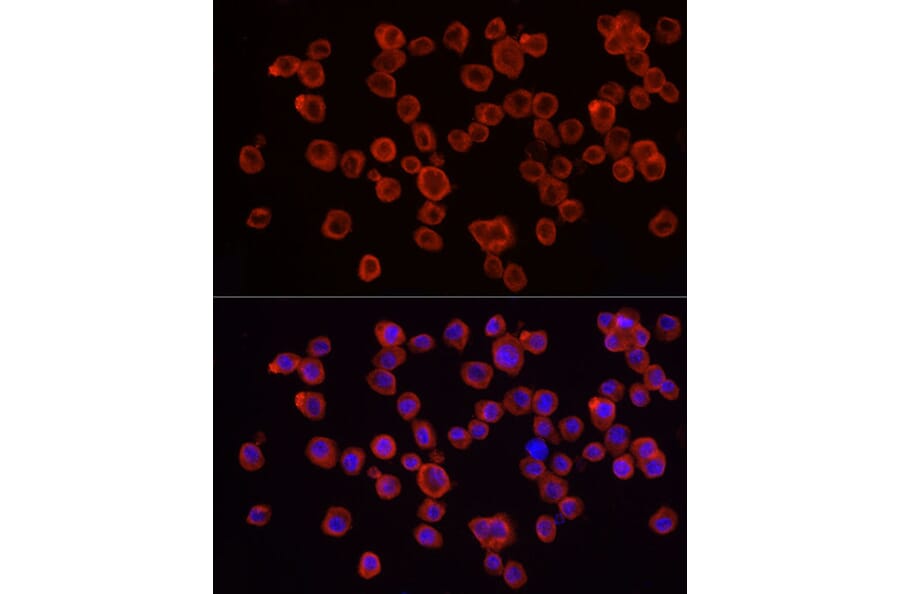 Immunofluorescence - Anti-IRAK4 Antibody (A307561) - Antibodies.com