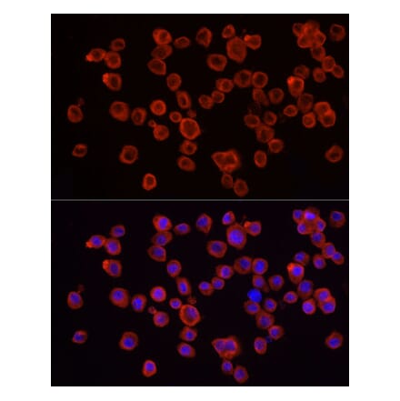 Immunofluorescence - Anti-IRAK4 Antibody (A307561) - Antibodies.com