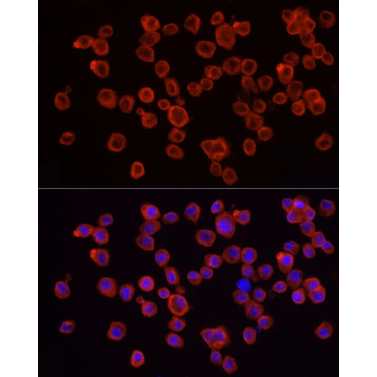 Immunofluorescence - Anti-IRAK4 Antibody (A307561) - Antibodies.com