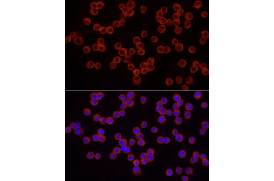 Immunofluorescence - Anti-IRAK4 Antibody (A307561) - Antibodies.com