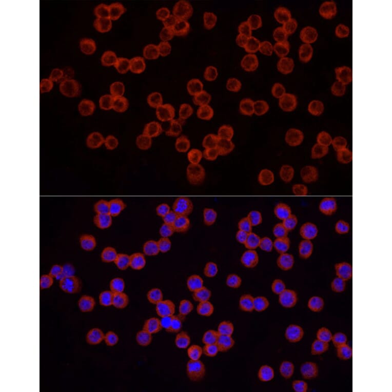 Immunofluorescence - Anti-IRAK4 Antibody (A307561) - Antibodies.com