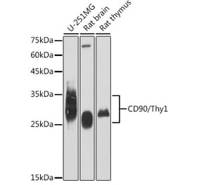 Western Blot - Anti-CD90 / Thy1 Antibody [ARC2609] (A307562) - Antibodies.com