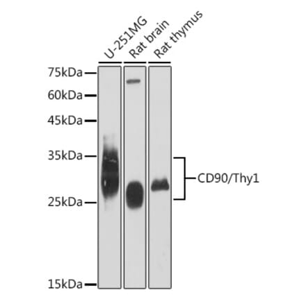 Western Blot - Anti-CD90 / Thy1 Antibody [ARC2609] (A307562) - Antibodies.com