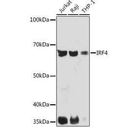 Western Blot - Anti-MUM1 Antibody [ARC1261] (A307563) - Antibodies.com