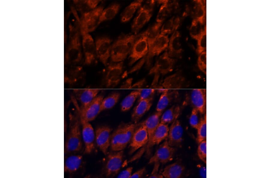 Immunofluorescence - Anti-PDE6G Antibody (A307564) - Antibodies.com