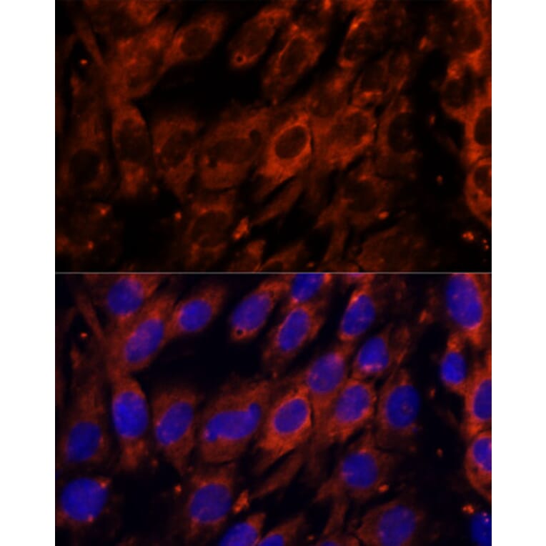 Immunofluorescence - Anti-PDE6G Antibody (A307564) - Antibodies.com