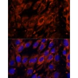 Immunofluorescence - Anti-PDE6G Antibody (A307564) - Antibodies.com