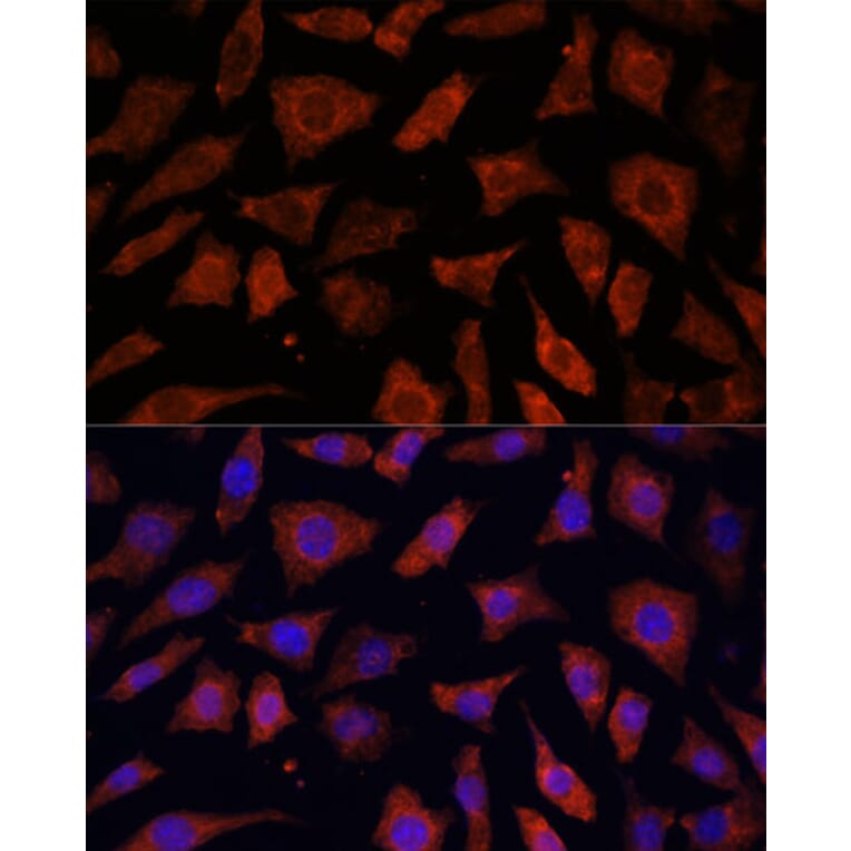 Immunofluorescence - Anti-PDE6G Antibody (A307564) - Antibodies.com