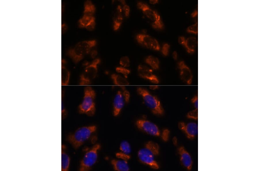 Immunofluorescence - Anti-PDE6G Antibody (A307564) - Antibodies.com