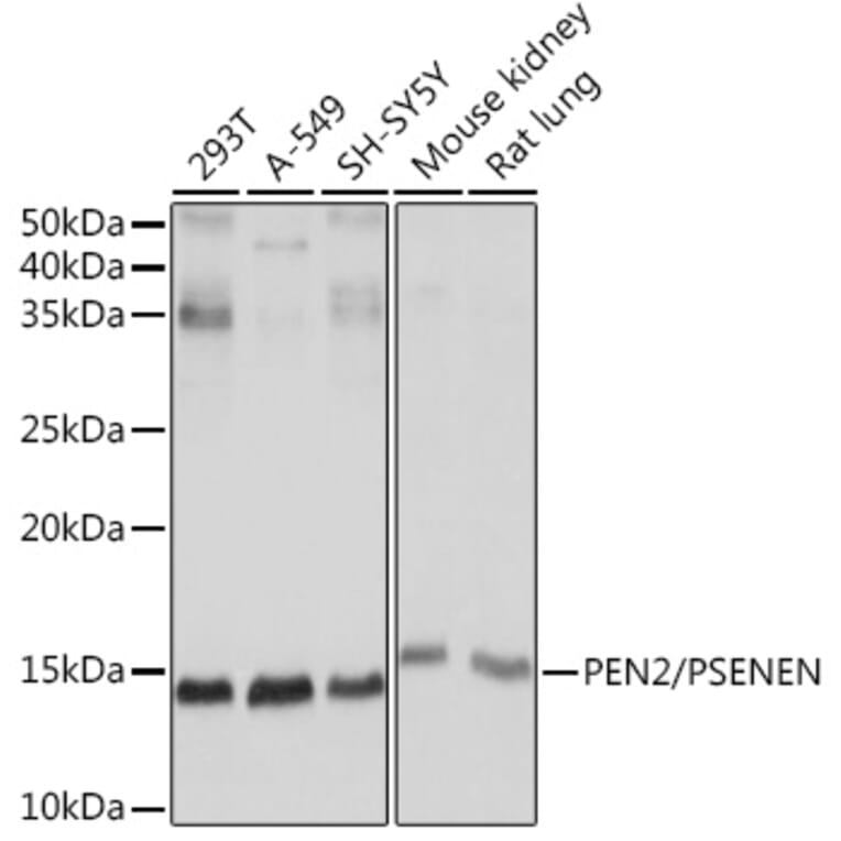 Western Blot - Anti-PEN2 Antibody [ARC1779] (A307565) - Antibodies.com