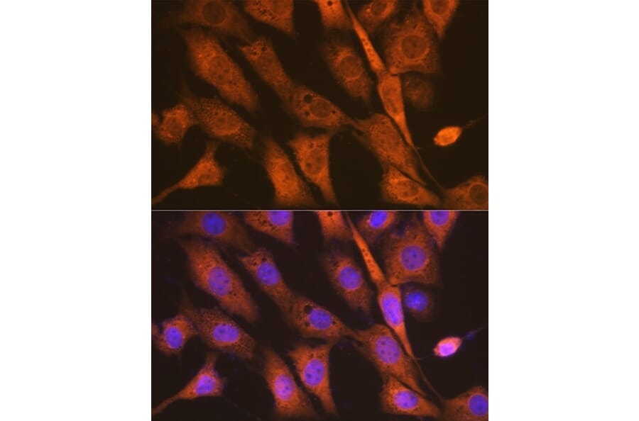 Immunofluorescence - Anti-PEN2 Antibody [ARC1779] (A307565) - Antibodies.com