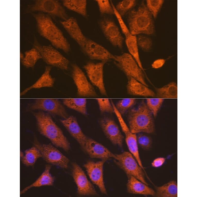 Immunofluorescence - Anti-PEN2 Antibody [ARC1779] (A307565) - Antibodies.com