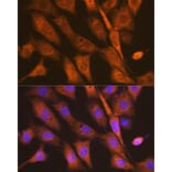 Immunofluorescence - Anti-PEN2 Antibody [ARC1779] (A307565) - Antibodies.com