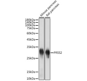 Western Blot - Anti-PRSS2 Antibody [ARC2453] (A307566) - Antibodies.com