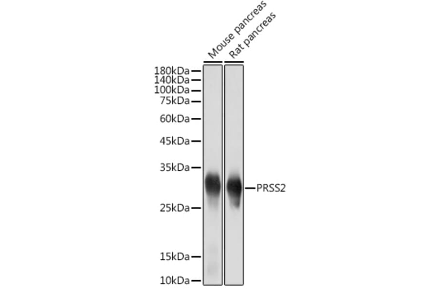 Western Blot - Anti-PRSS2 Antibody [ARC2453] (A307566) - Antibodies.com
