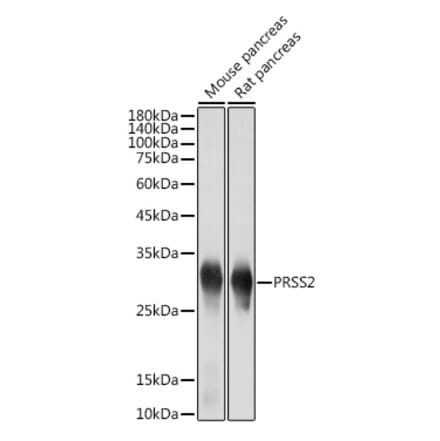 Western Blot - Anti-PRSS2 Antibody [ARC2453] (A307566) - Antibodies.com