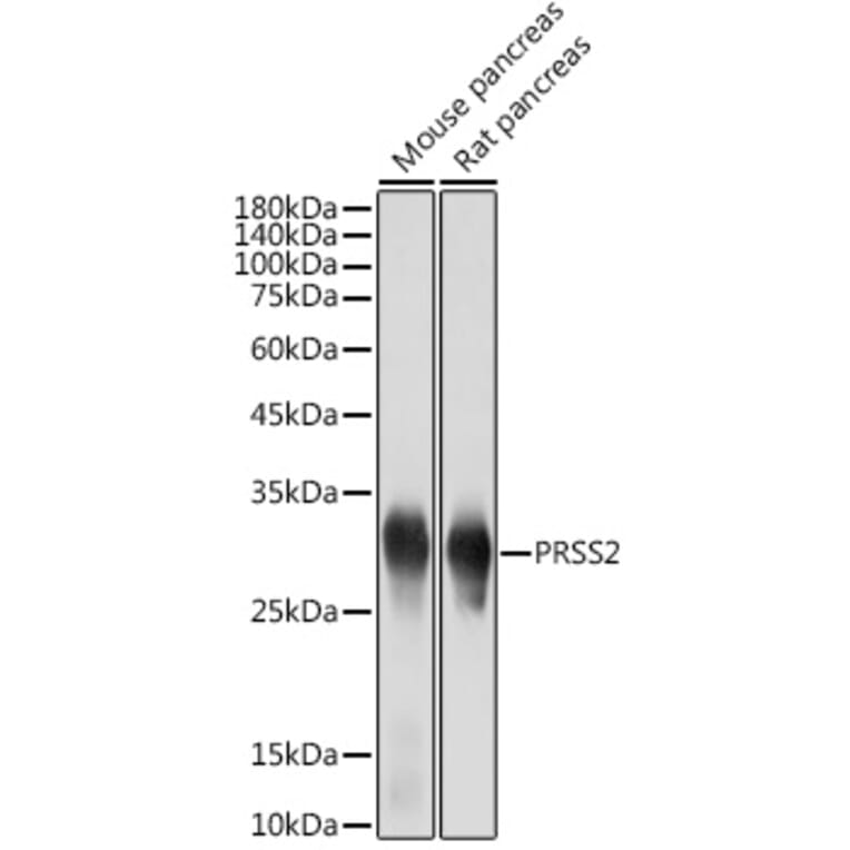 Western Blot - Anti-PRSS2 Antibody [ARC2453] (A307566) - Antibodies.com