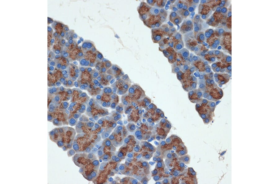 Immunohistochemistry - Anti-PRSS2 Antibody [ARC2453] (A307566) - Antibodies.com