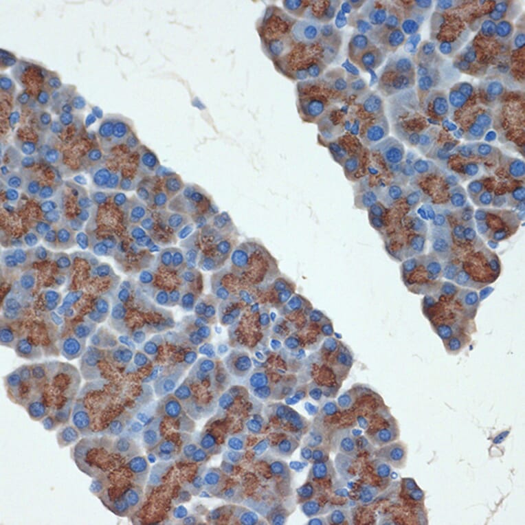 Immunohistochemistry - Anti-PRSS2 Antibody [ARC2453] (A307566) - Antibodies.com