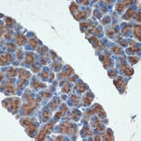 Immunohistochemistry - Anti-PRSS2 Antibody [ARC2453] (A307566) - Antibodies.com