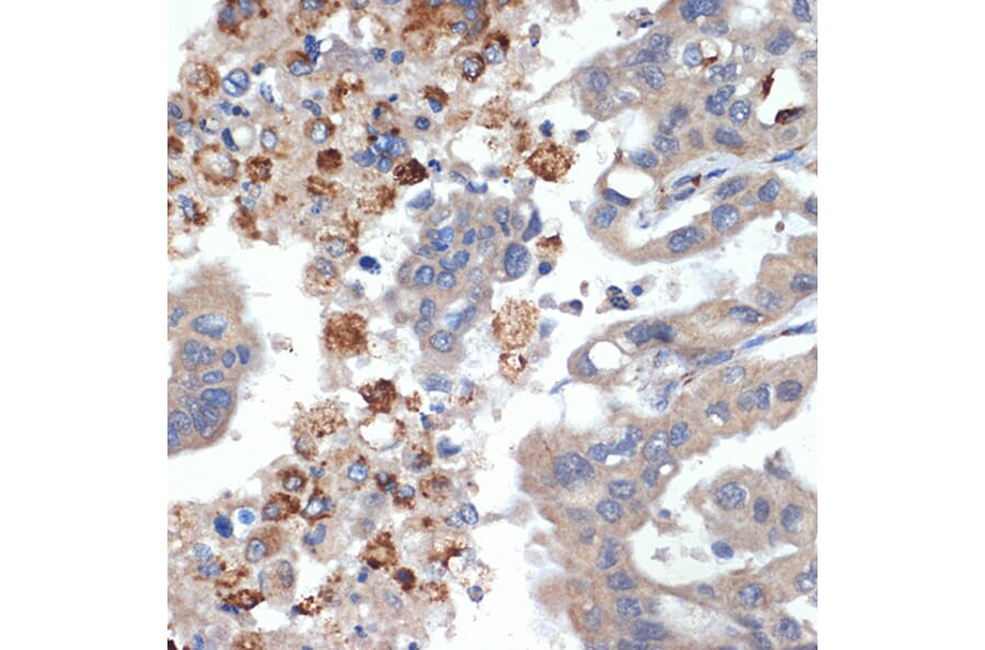 Immunohistochemistry - Anti-PRSS2 Antibody [ARC2453] (A307566) - Antibodies.com