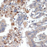 Immunohistochemistry - Anti-PRSS2 Antibody [ARC2453] (A307566) - Antibodies.com