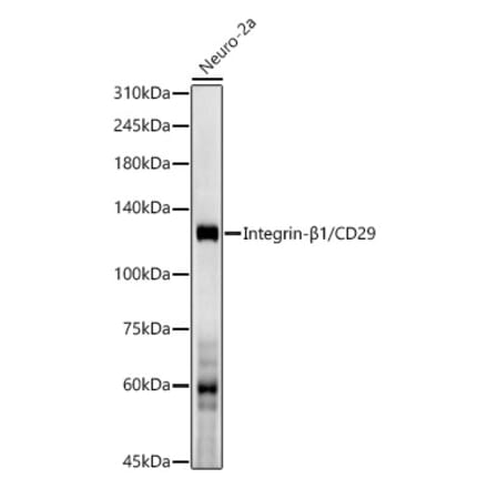 Western Blot - Anti-Integrin beta 1 Antibody [ARC52467 + ARC52468] (A307567) - Antibodies.com