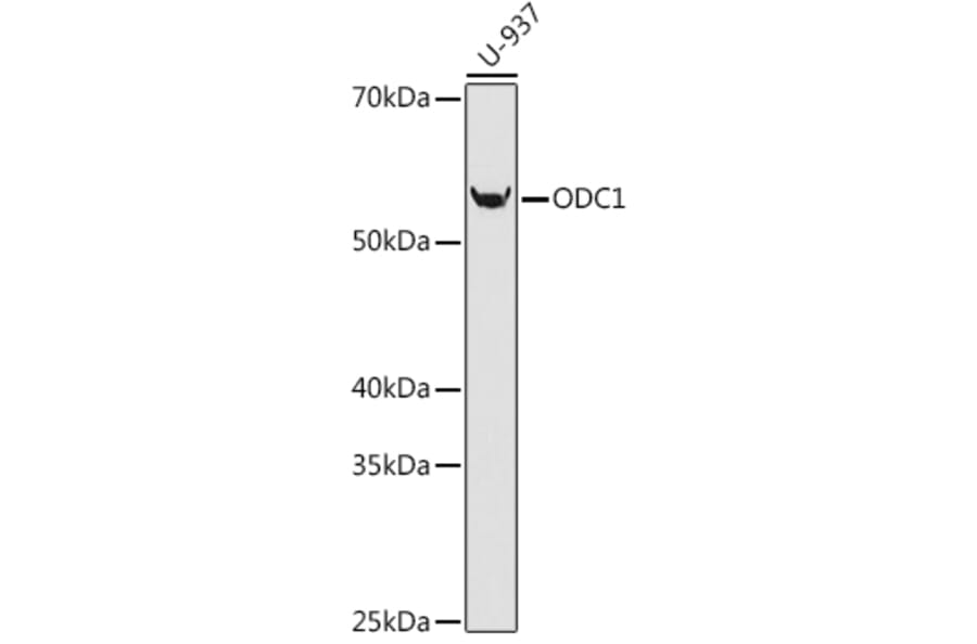 Western Blot - Anti-Ornithine Decarboxylase/ODC Antibody [ARC0863] (A307571) - Antibodies.com