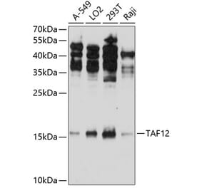 Western Blot - Anti-TAF12 Antibody (A307575) - Antibodies.com