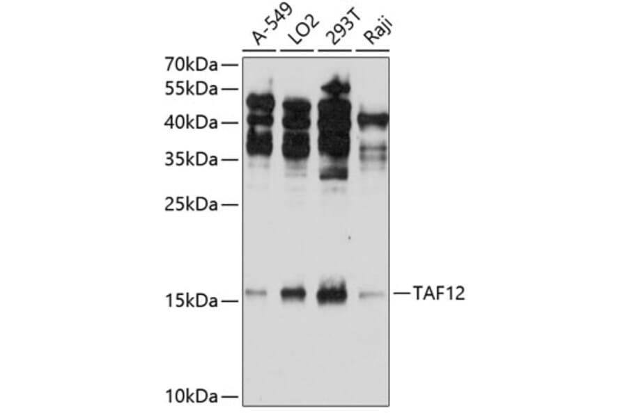Western Blot - Anti-TAF12 Antibody (A307575) - Antibodies.com