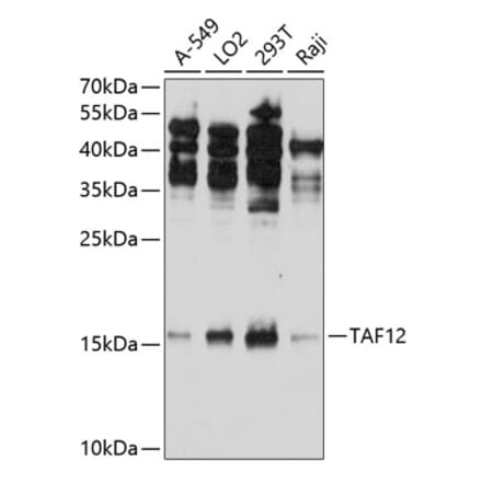 Western Blot - Anti-TAF12 Antibody (A307575) - Antibodies.com