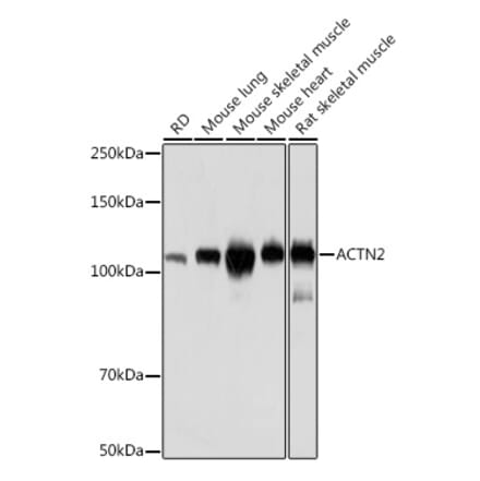 Western Blot - Anti-Sarcomeric Alpha Actinin Antibody [ARC1360] (A307576) - Antibodies.com